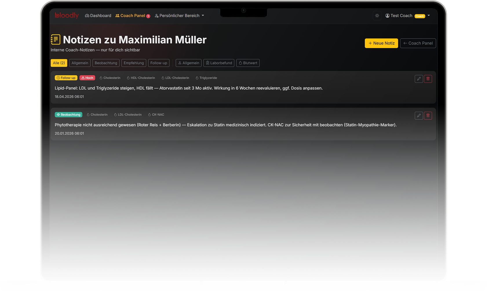 Coach-Notiz auf dem Macbook