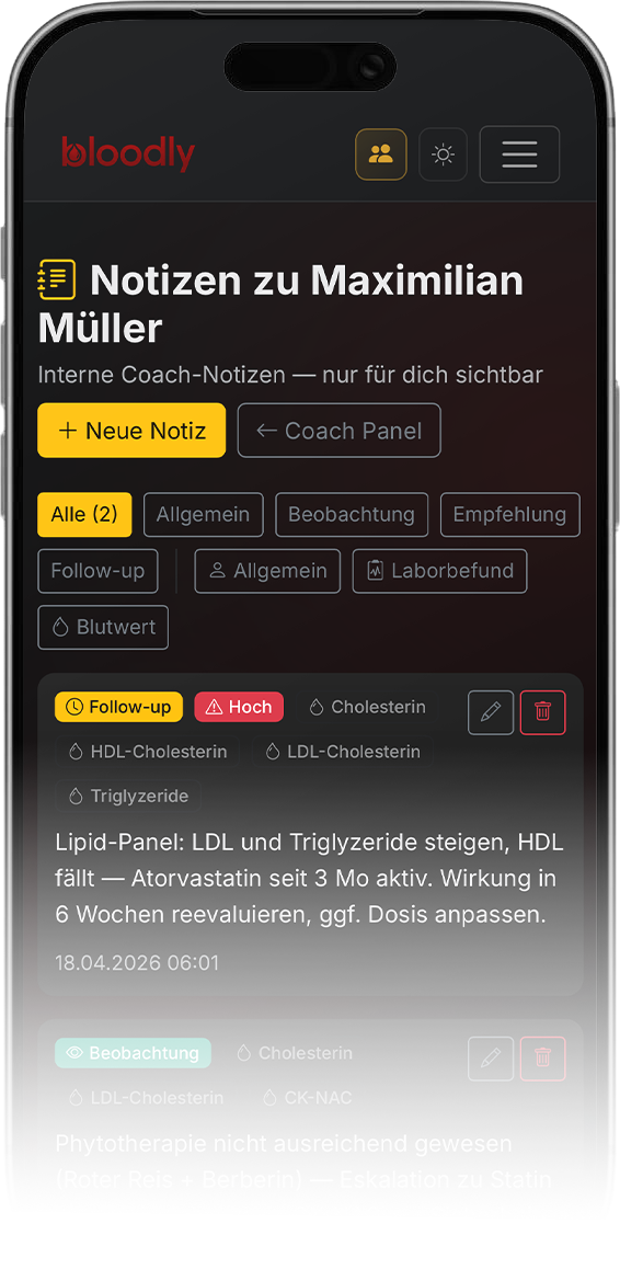 Coach-Notiz auf dem iPhone