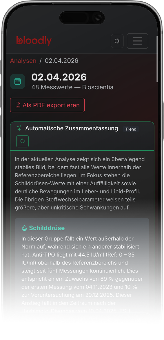 Auto-Zusammenfassung auf dem iPhone