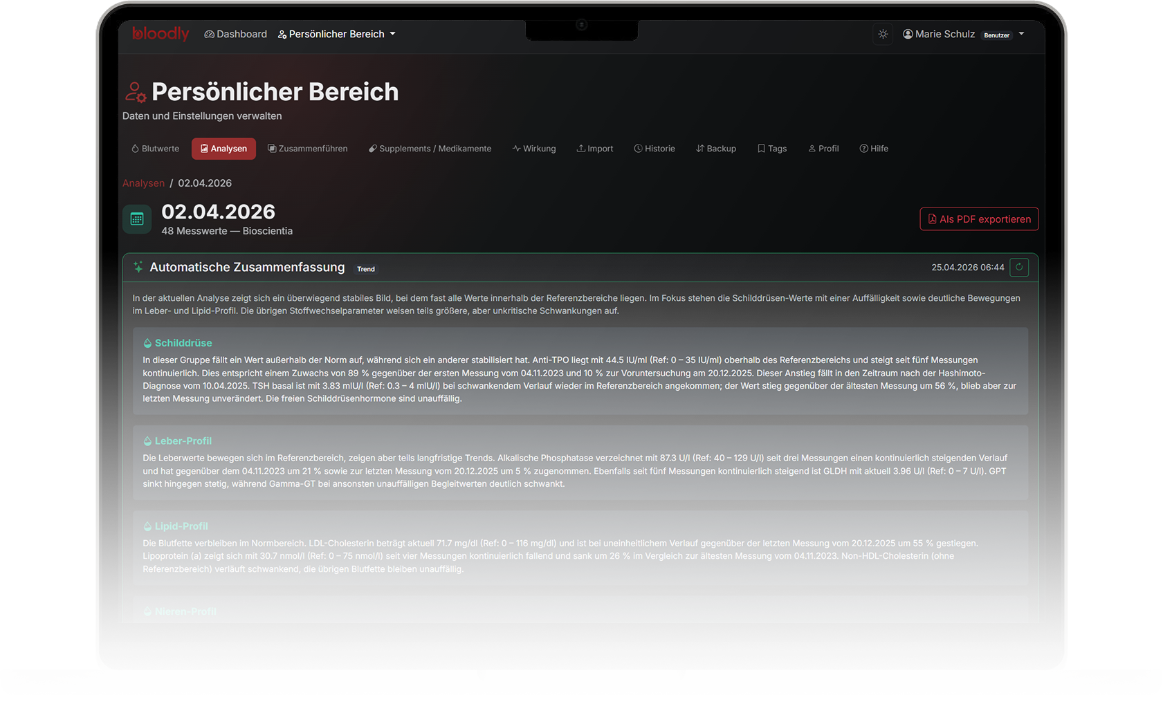 Auto-Zusammenfassung auf dem Macbook